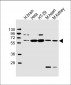 ETV1 Antibody (C-Term)